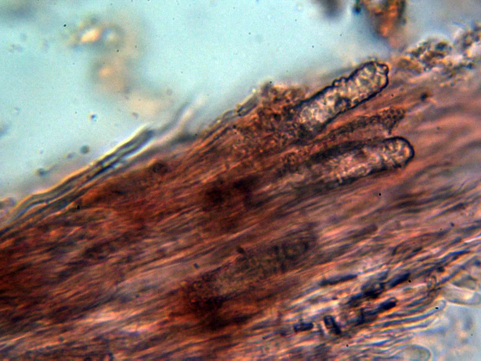 Microscopía de Steccherinum ochraceum - 12 - Cistidios